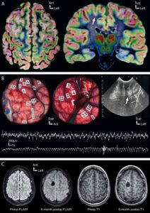 Une image contenant capture d’écran, cercle, Cerveau Le contenu généré par l’IA peut être incorrect.