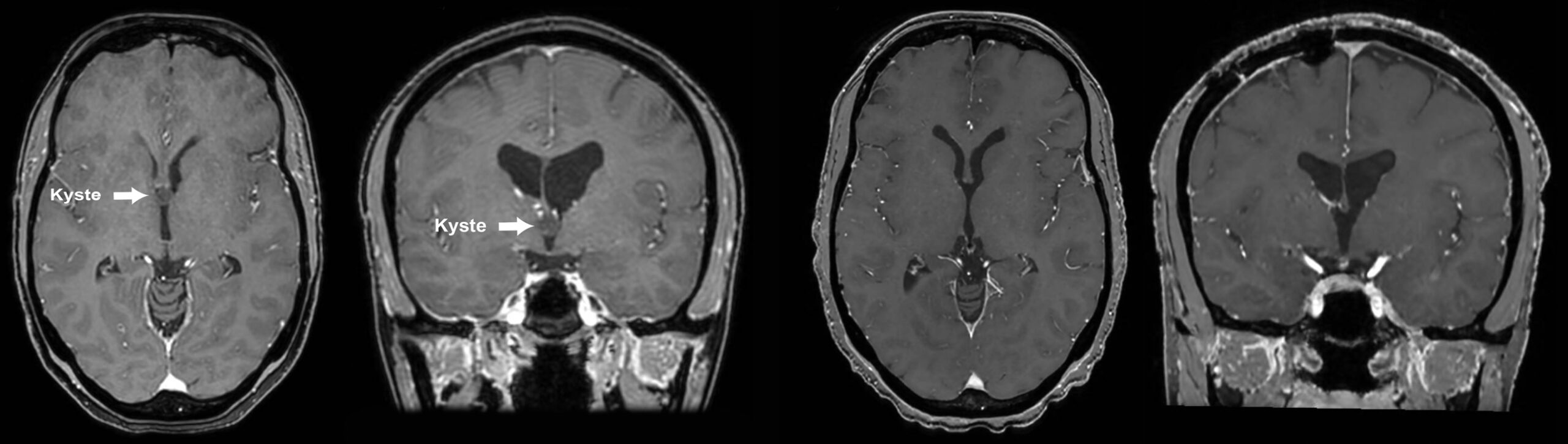 Une image contenant cercle, noir, noir et blanc, monochrome
Le contenu généré par l’IA peut être incorrect.