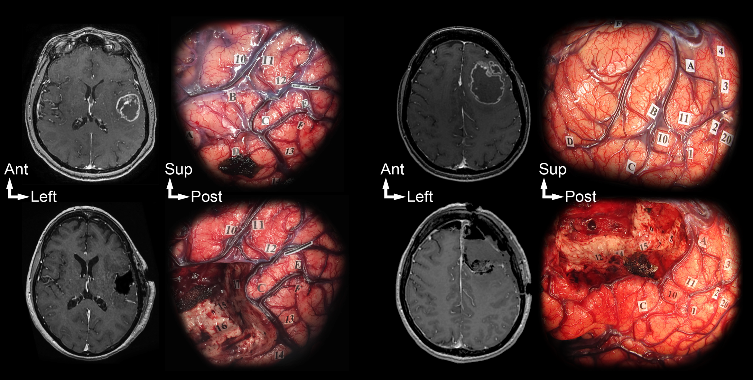 Une image contenant Cerveau
Le contenu généré par l’IA peut être incorrect.