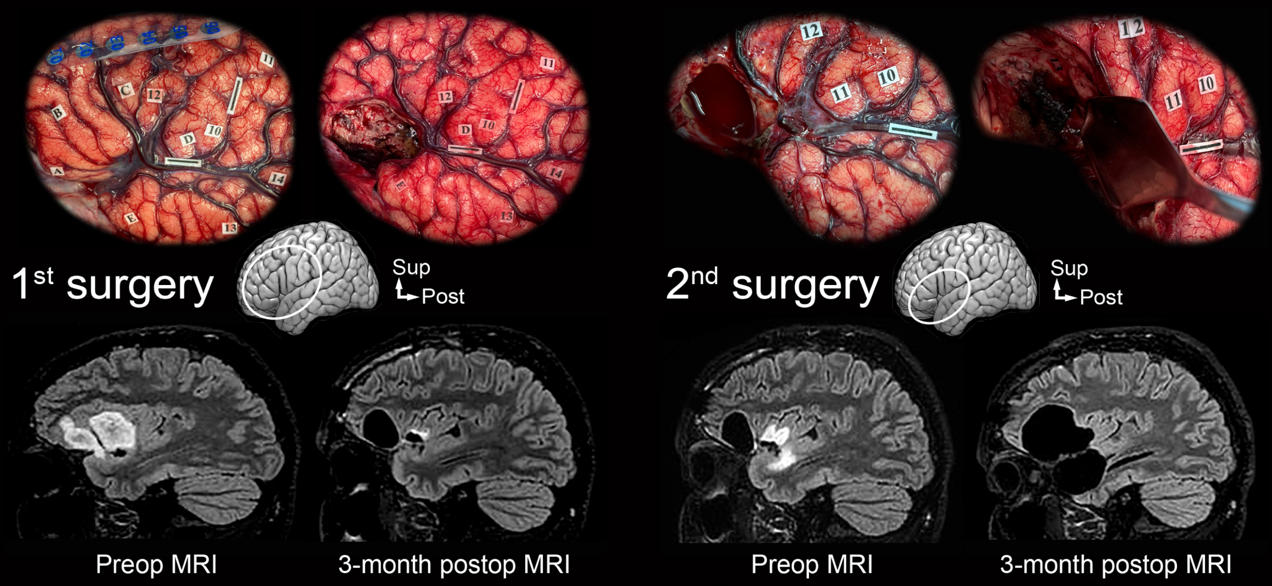 Une image contenant Cerveau
Le contenu généré par l’IA peut être incorrect.