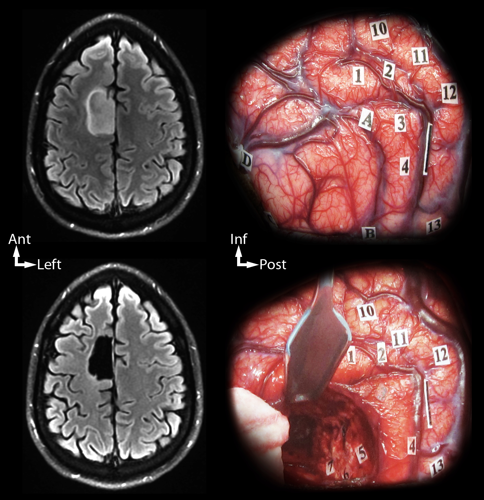Une image contenant Imagerie médicale, médical, radiologie, film radiographique
Le contenu généré par l’IA peut être incorrect.