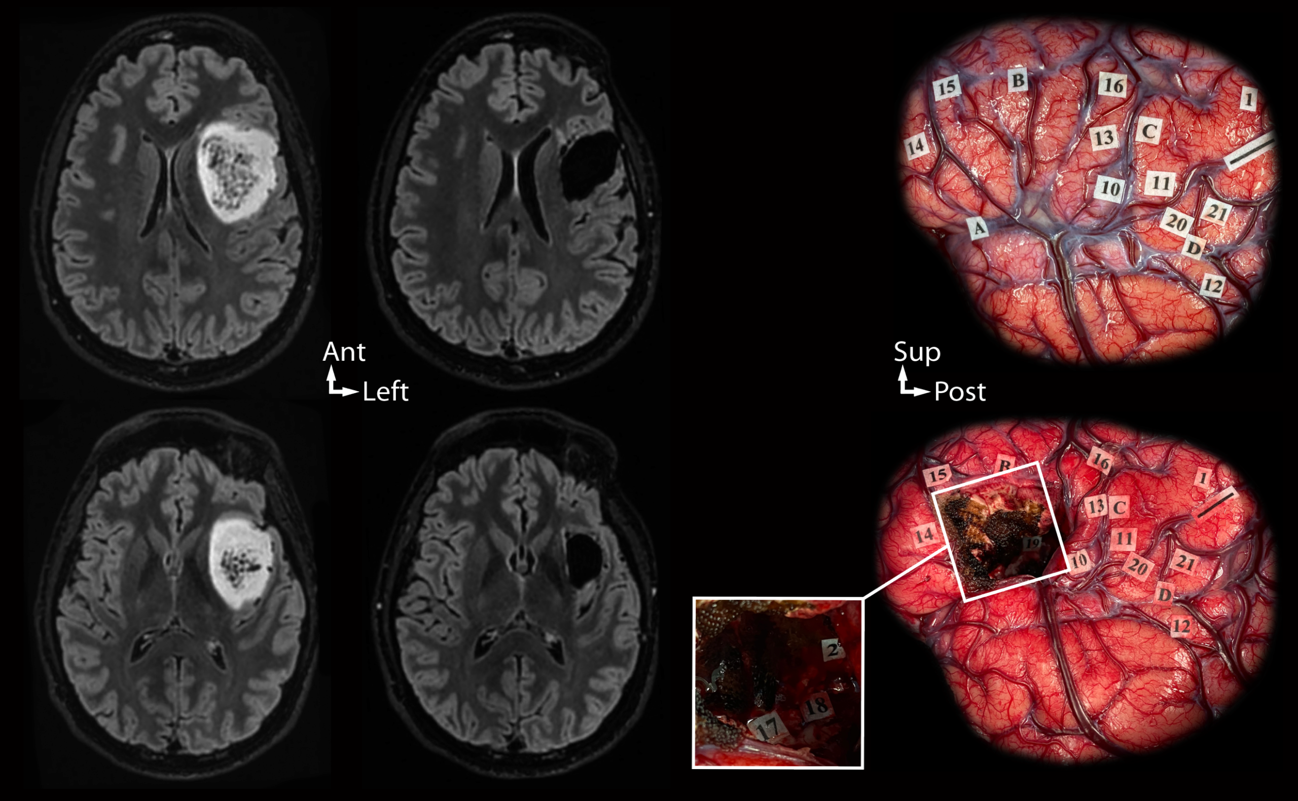 Une image contenant Imagerie médicale, radiologie, film radiographique
Le contenu généré par l’IA peut être incorrect.
