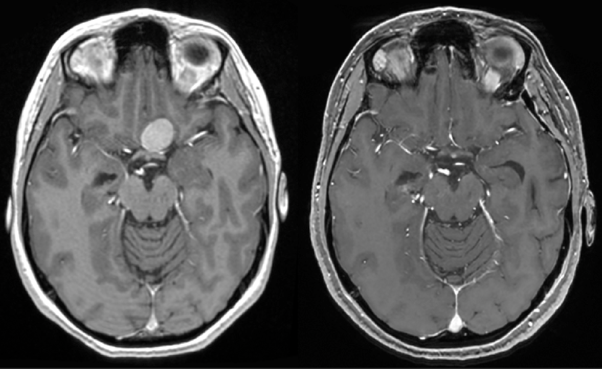Une image contenant cercle, Imagerie médicale, Rayon X, film radiographique
Le contenu généré par l’IA peut être incorrect.