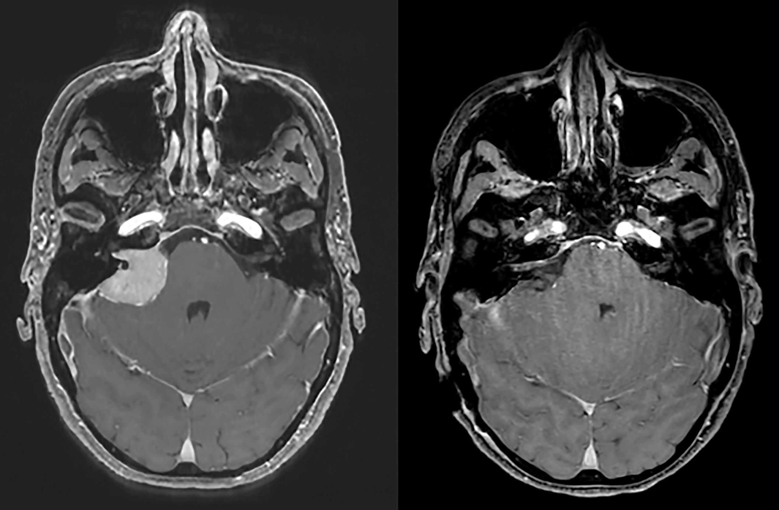 Une image contenant cercle, noir et blanc, monochrome
Le contenu généré par l’IA peut être incorrect.