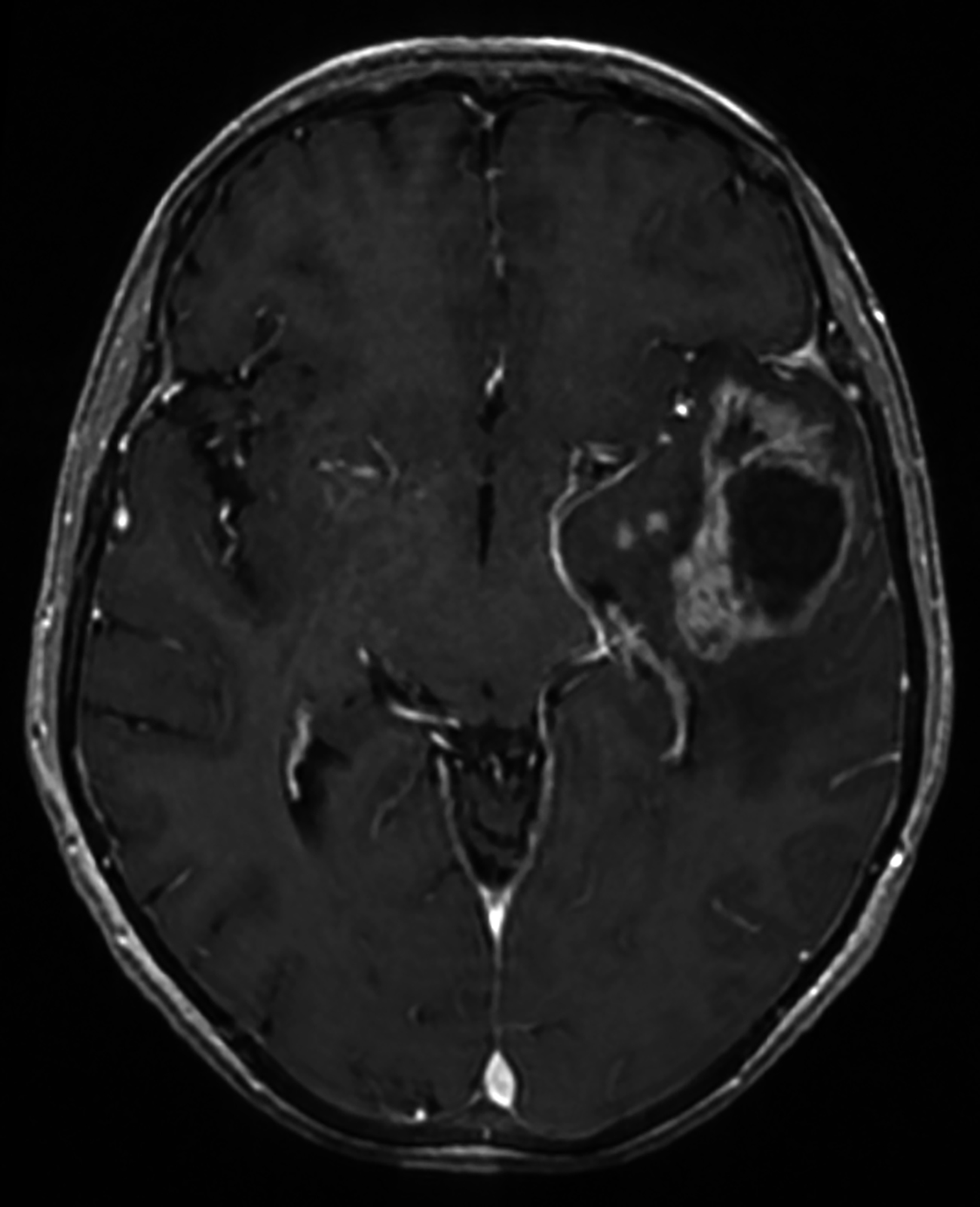 Une image contenant cercle, pièce, monochrome

Le contenu généré par l’IA peut être incorrect.