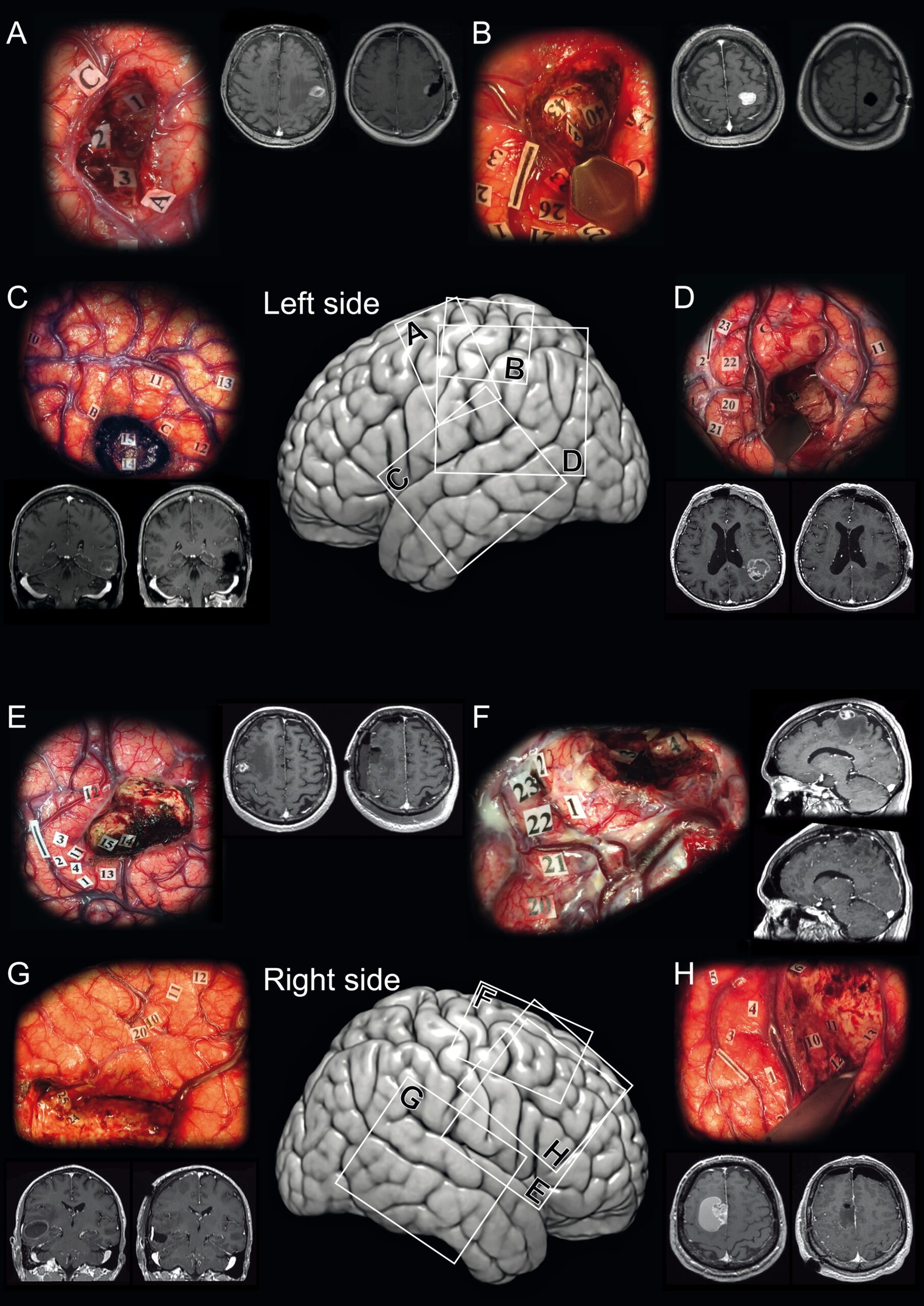 Une image contenant Cerveau, capture d’écran
Le contenu généré par l’IA peut être incorrect.