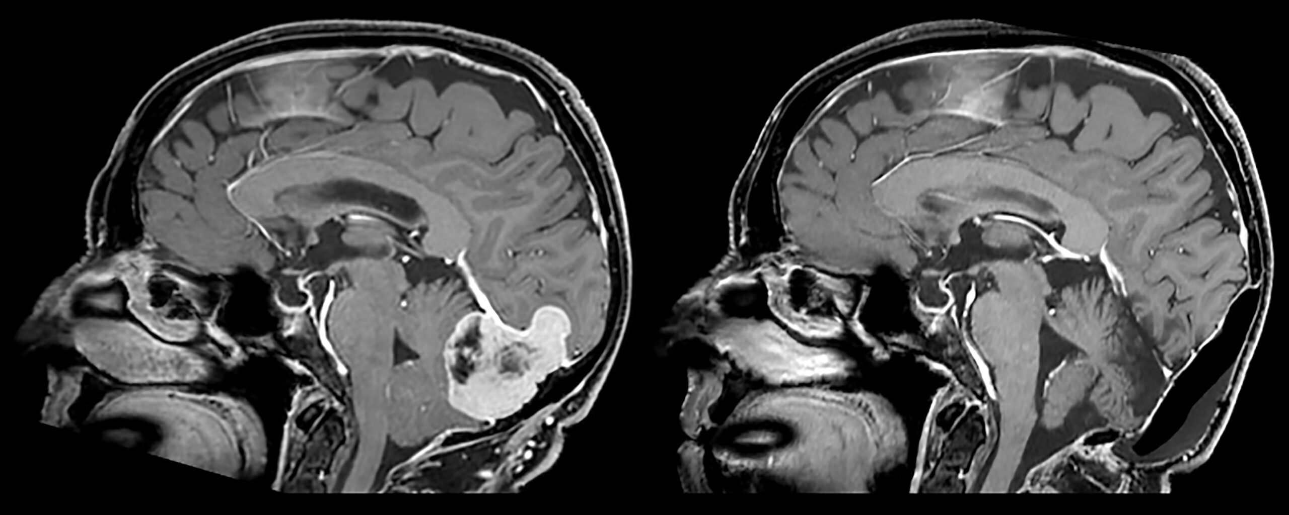 Une image contenant Imagerie médicale, film radiographique, radiologie, radiographie
Le contenu généré par l’IA peut être incorrect.
