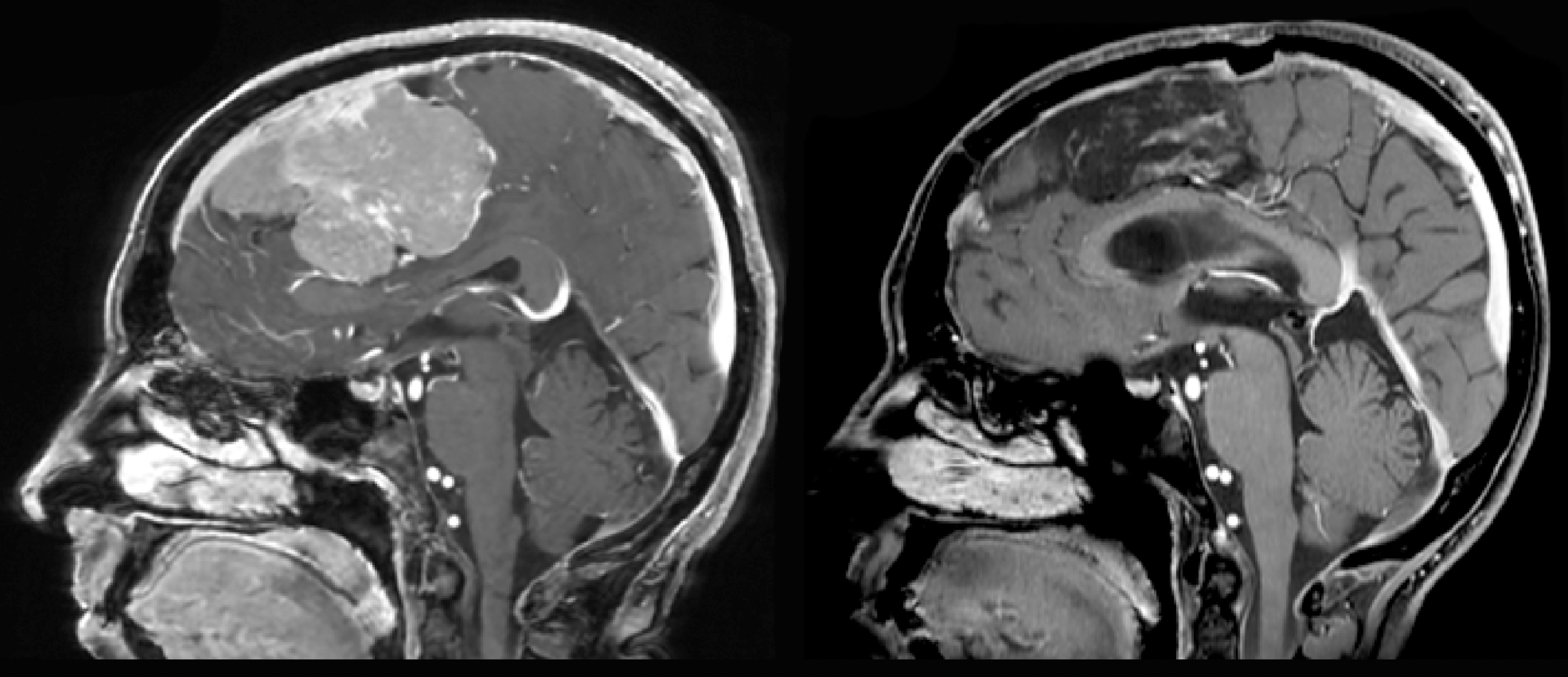 Une image contenant Imagerie médicale, film radiographique, radiologie, radiographie
Le contenu généré par l’IA peut être incorrect.