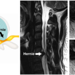 Une image contenant Imagerie médicale, radiologie, Radiographie médicale, film radiographique Le contenu généré par l’IA peut être incorrect.