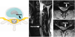 Une image contenant Imagerie médicale, radiologie, Radiographie médicale, film radiographique Le contenu généré par l’IA peut être incorrect.