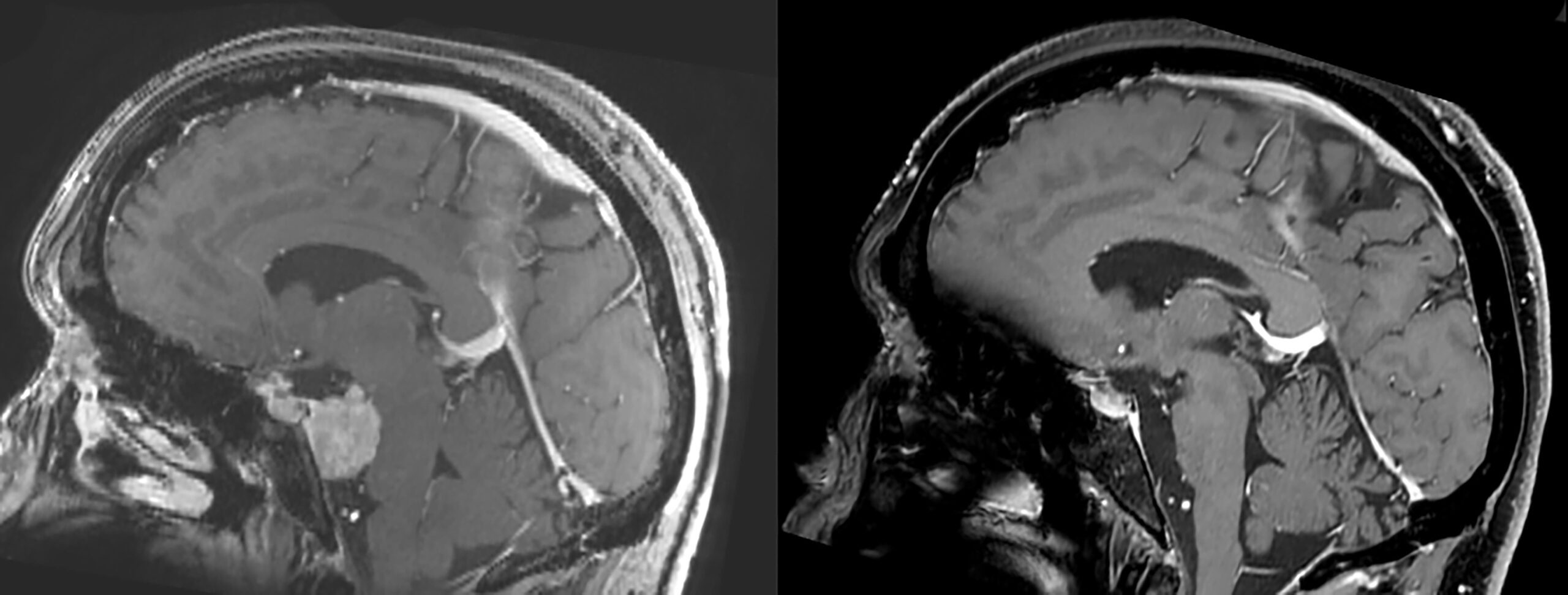 Une image contenant Imagerie médicale, radiologie, noir et blanc, film radiographique
Le contenu généré par l’IA peut être incorrect.