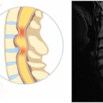 Une image contenant Imagerie médicale, Rayon X, radiologie, radiographie Le contenu généré par l’IA peut être incorrect.