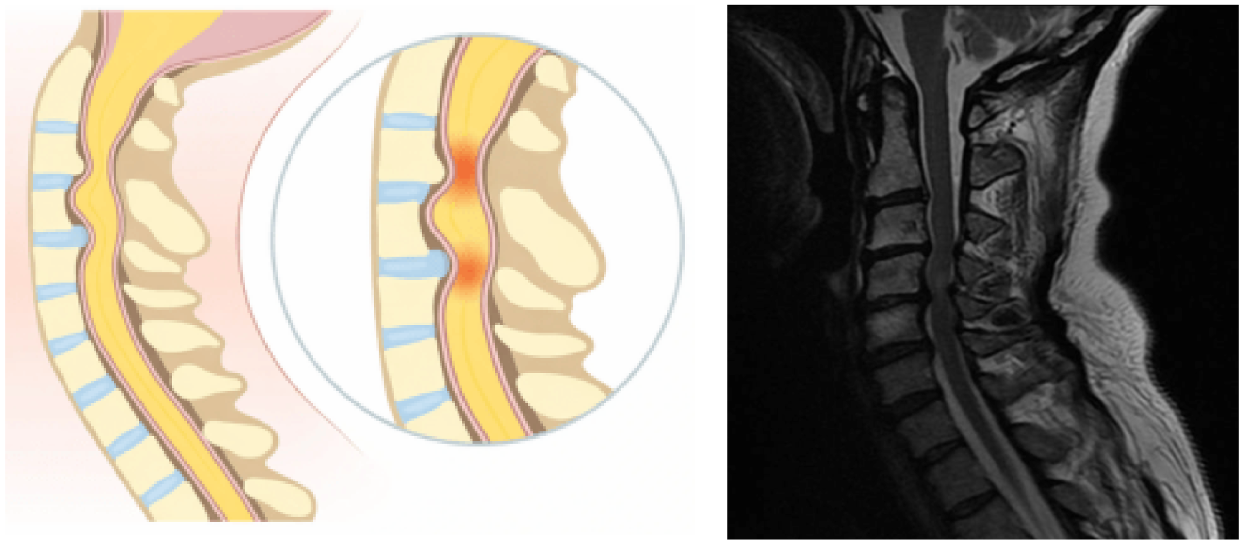 Une image contenant Imagerie médicale, Rayon X, radiologie, radiographie
Le contenu généré par l’IA peut être incorrect.