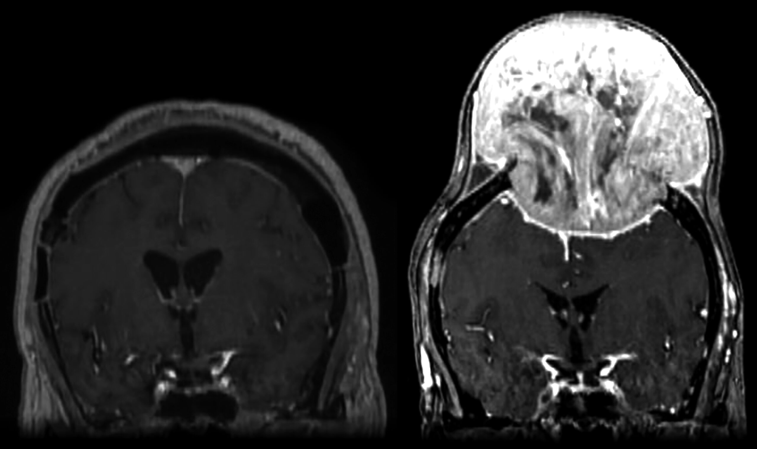 Une image contenant monochrome, Imagerie médicale, noir et blanc, film radiographique
Le contenu généré par l’IA peut être incorrect.