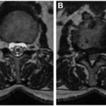Une image contenant noir, capture d’écran, noir et blanc, film radiographique Le contenu généré par l’IA peut être incorrect.