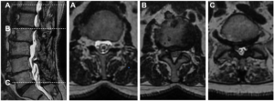 Une image contenant noir, capture d’écran, noir et blanc, film radiographique Le contenu généré par l’IA peut être incorrect.